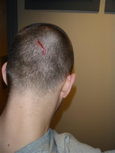 Head Gash